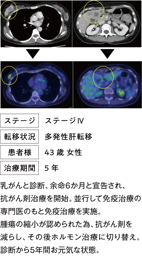 治療例1